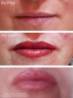 /album/fotogalerie/rty-2022-jpg10-jpg/